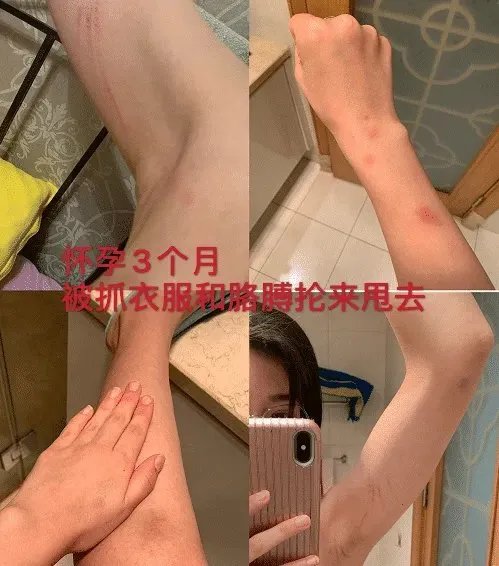 短跑名将婚内出轨，并多次实施家暴，是运动员都这样吗？