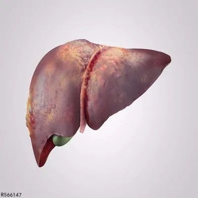 肝胆内管结石的排石方法有哪些