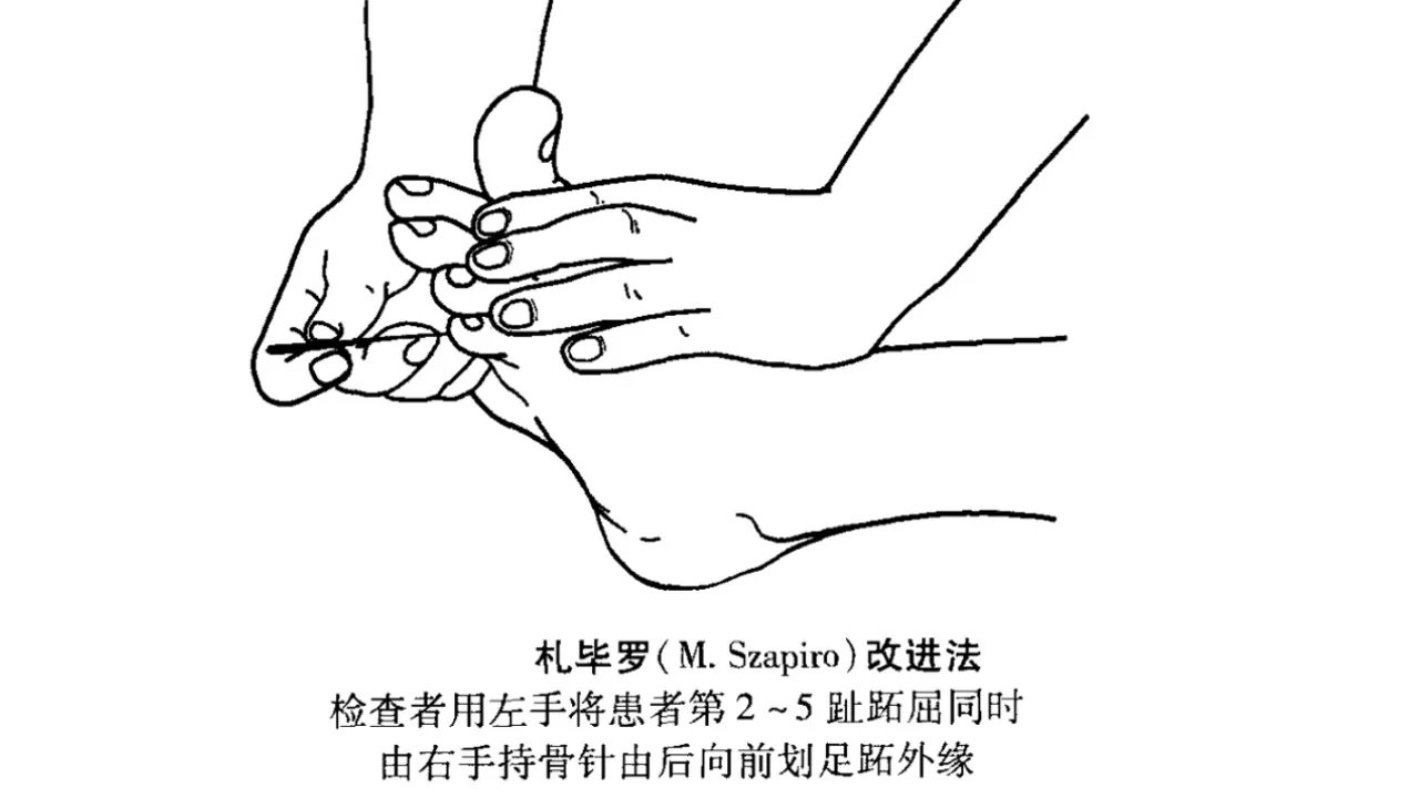 理解Babinski征,划对Babinski征