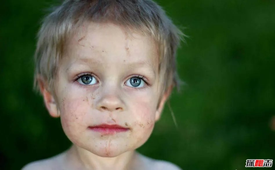 世界上最稀有的眼睛;紫色眼睛（概率只有千万分之一）