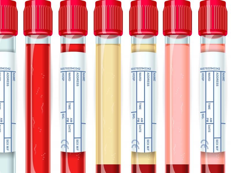 产后血晕的原因和预防保健