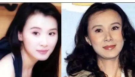 哪些女明星本来很好看却要整容，还越整越丑？