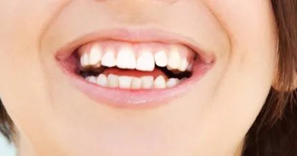 刷牙时牙龈出血是怎么回事