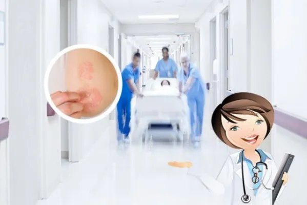 癣是什么原因引起的