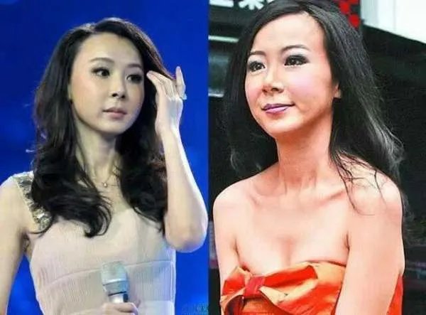 有哪些明星整容整的很失败的案例？
