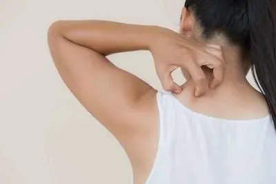 如何治疗喝酒皮肤过敏 破解酒精过敏有4要点