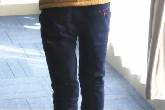 痔疮的最佳治疗方法是什么