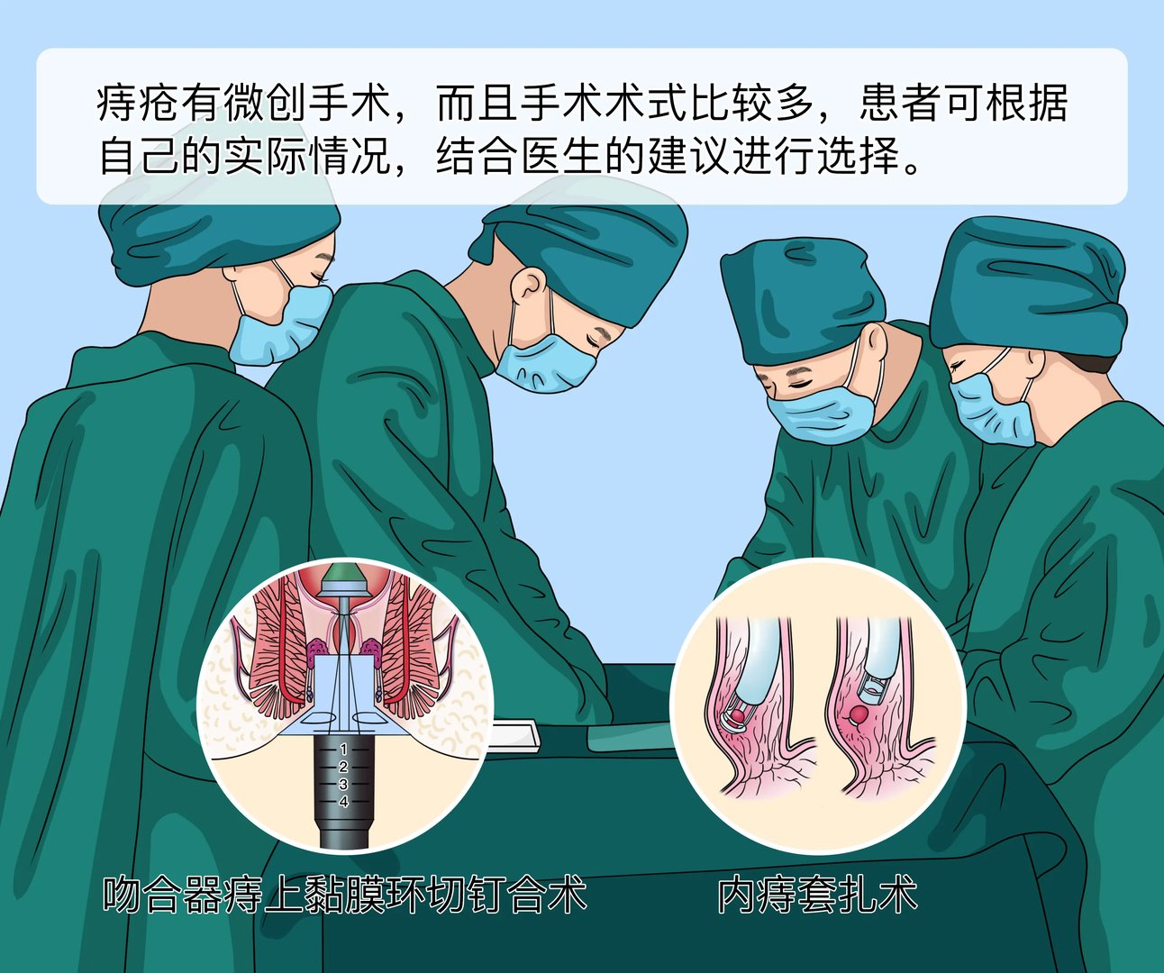 痔疮有微创手术吗