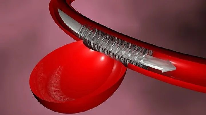 癌症的临床表现