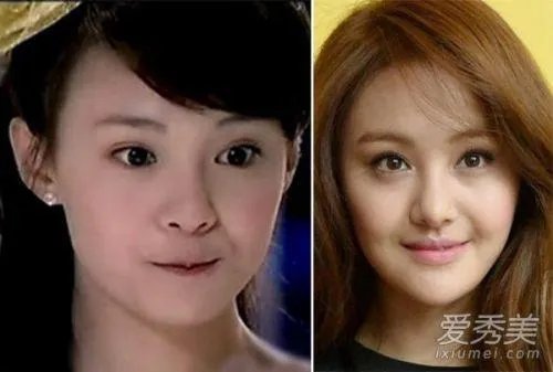 哪些女明星本来很好看却要整容，还越整越丑？