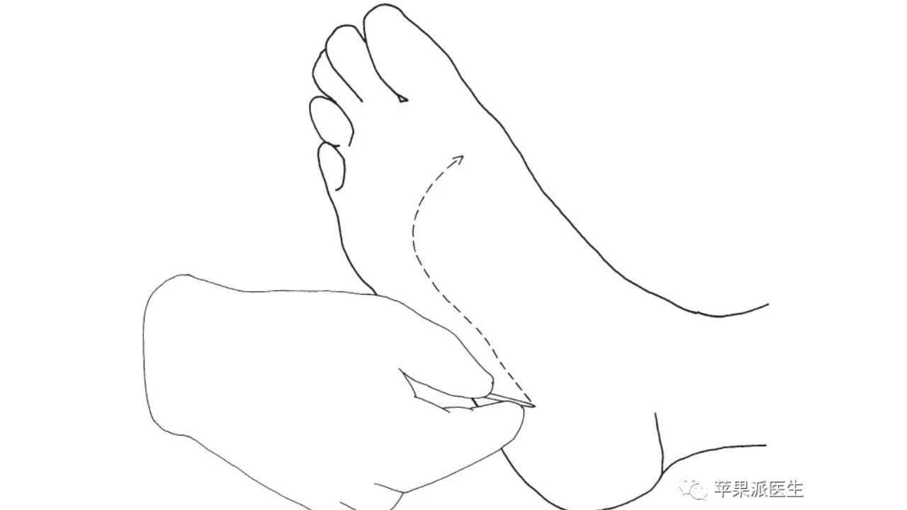 理解Babinski征，划对Babinski征