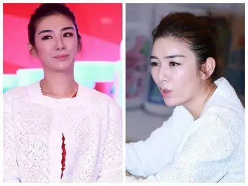 哪些女明星本来很好看却要整容，还越整越丑？