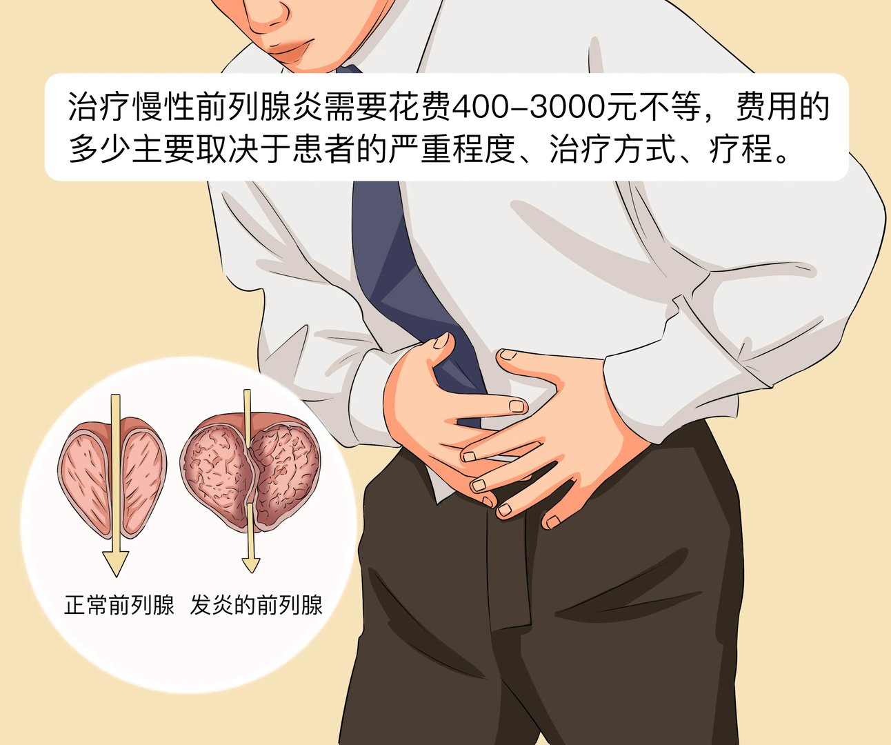慢性前列腺炎治疗需要花费多少钱