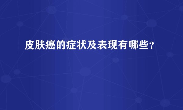 皮肤癌的症状及表现有哪些？