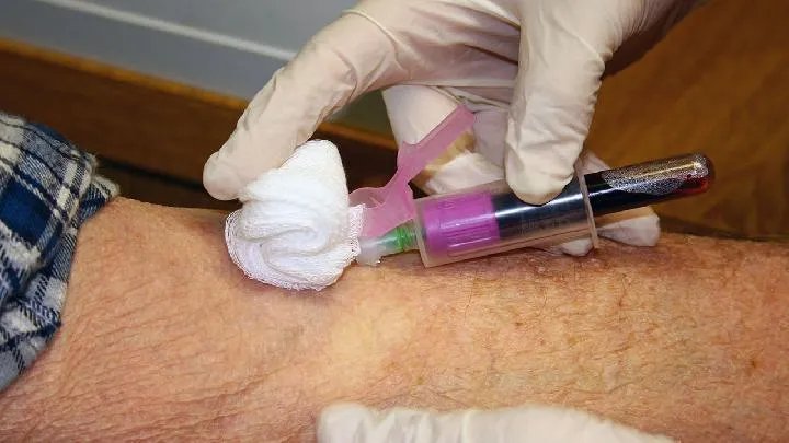 再生障碍性贫血护理方法有什么?