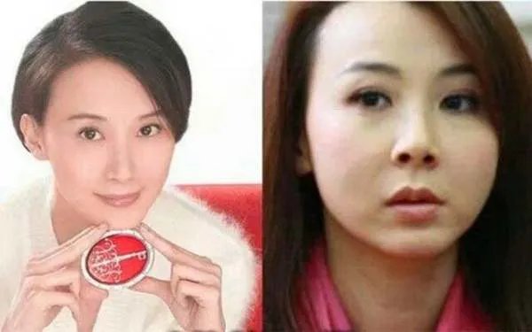有哪些明星整容整的很失败的案例？