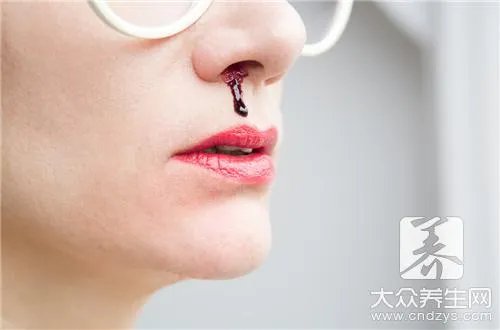  鼻出血的主要原因