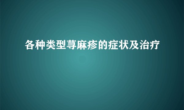 各种类型荨麻疹的症状及治疗