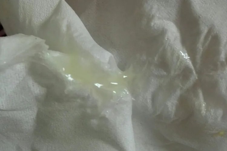 月经前正常分泌物图片