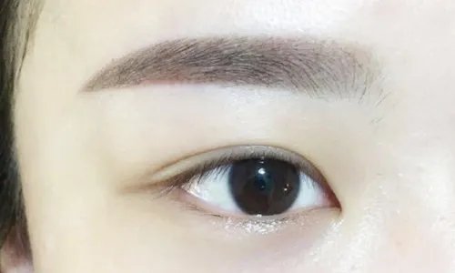 2021四川米兰柏羽医学美容医院眼窝凹陷修复价格表(价目表)怎么样?