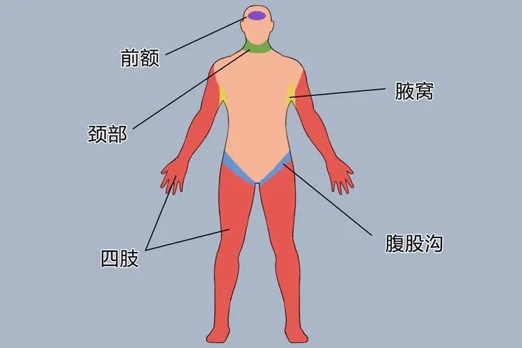 发烧用温水擦哪些部位
