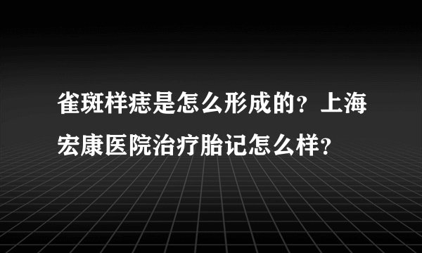 雀斑样痣是怎么形成的？上海宏康医院治疗胎记怎么样？