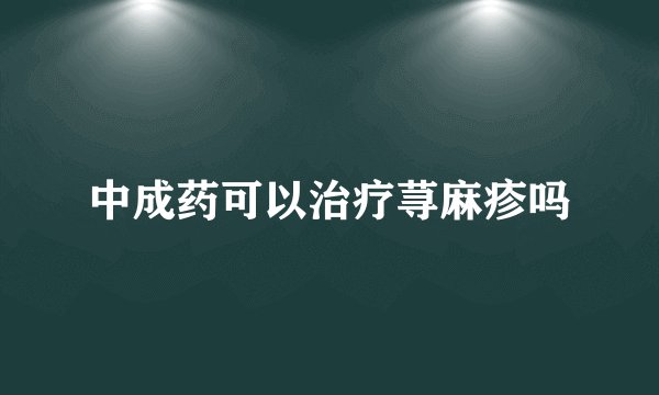 中成药可以治疗荨麻疹吗