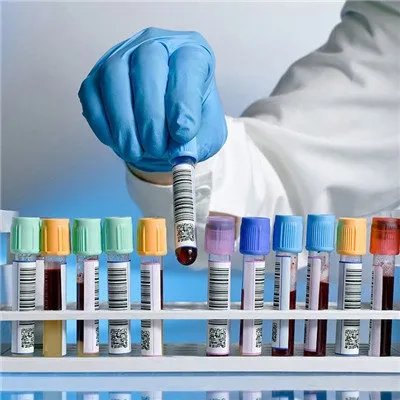 溶血性链球菌感染的症状