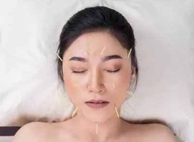 针灸美容祛皱效果怎样 针灸美容祛皱的优缺点细说