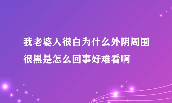 我老婆人很白为什么外阴周围很黑是怎么回事好难看啊
