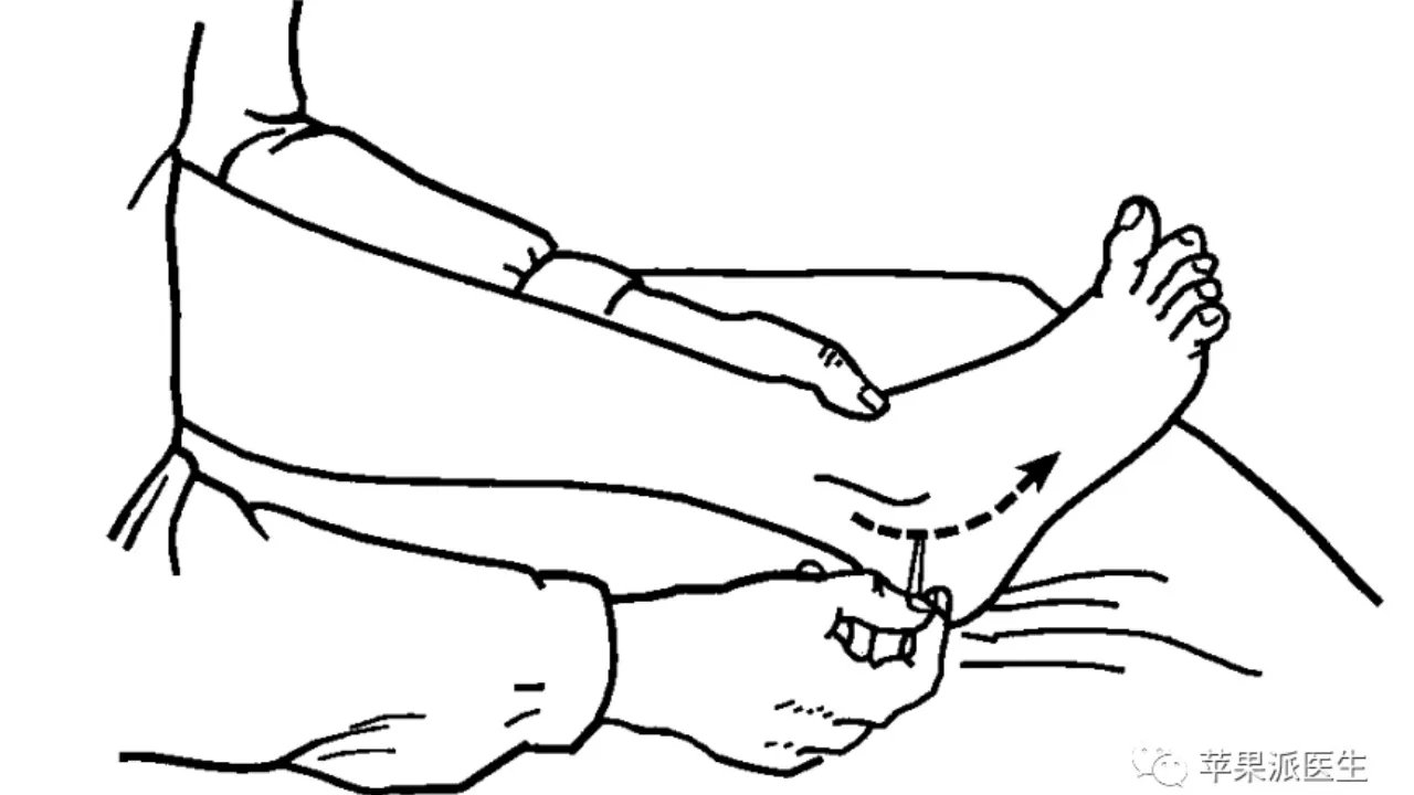 理解Babinski征,划对Babinski征
