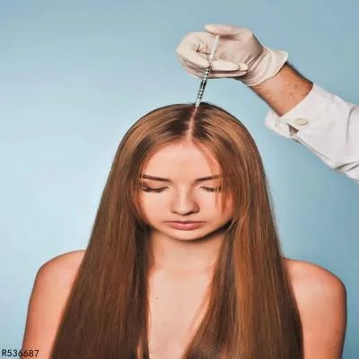 脂溢性脱发怎么改善