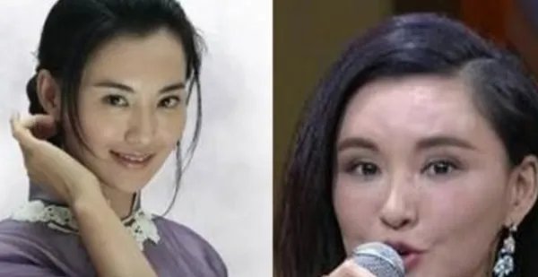 中国有没有整容失败的女明星？都有谁？