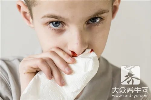  鼻出血的主要原因