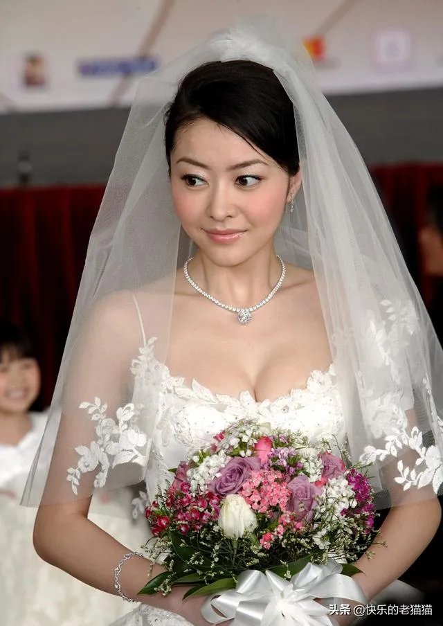 熊黛林整容有更美吗？