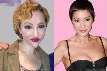 哪些女明星本来很好看却要整容，还越整越丑？