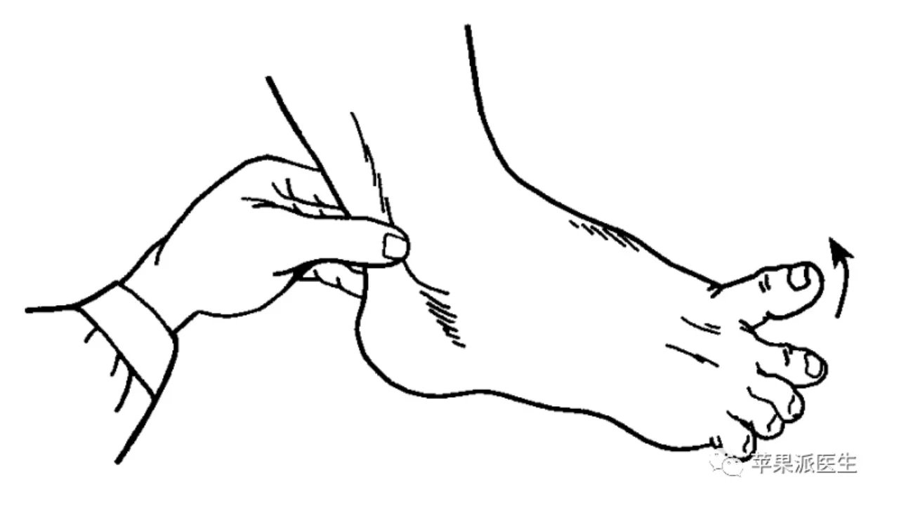 理解Babinski征,划对Babinski征