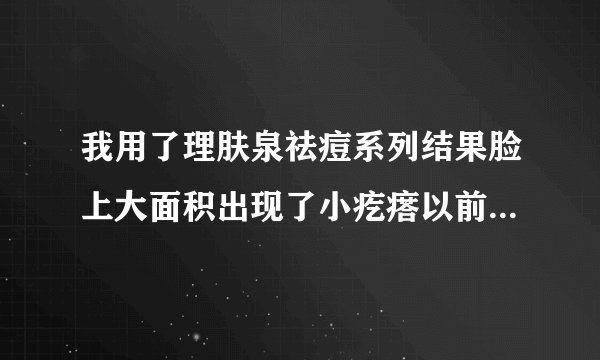 我用了理肤泉祛痘系列结果脸上大面积出现了小疙瘩以前也有长青春痘，但从来没有长这种米粒状的小