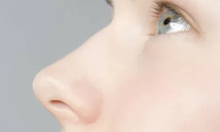 南京玻尿酸隆鼻多少钱