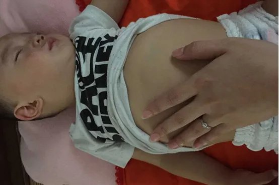 宝宝肚子胀气怎么办