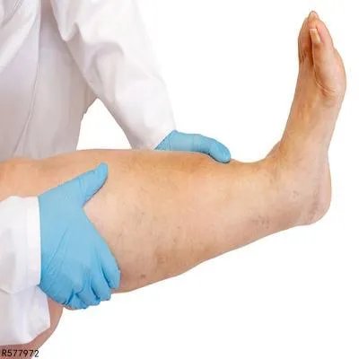 下肢神经炎的症状有哪些 下肢神经炎的3个症状科普