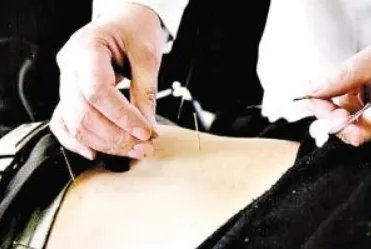 针灸减肥好吗？为什么？