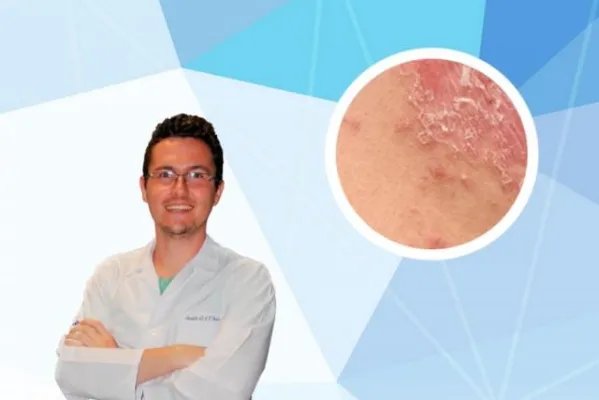 癣是什么原因引起的