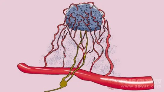 癌症最害怕吃什么食物