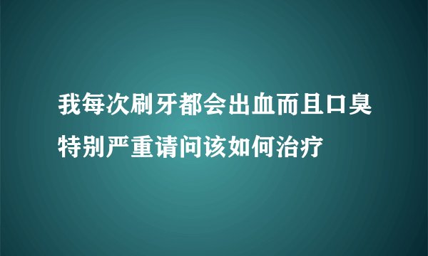 我每次刷牙都会出血而且口臭特别严重请问该如何治疗
