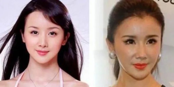 中国有没有整容失败的女明星？都有谁？