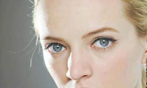 硅胶隆鼻手术后的注意事项