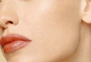 光子嫩肤祛斑治疗的价格