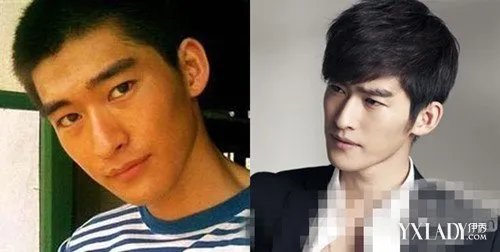 张翰整容前后照片张翰整容了吗