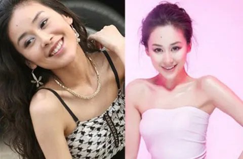 周扬整容前后对比 整完更加美丽动人